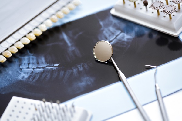FOLLOW-ME! e DGSHAPE aiutano gli odontotecnici a raggiungere la perfezione